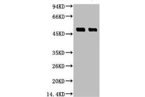 Western blot analysis of 1) Hela, 2) 293T, diluted at 1:3000. (XRCC4 抗体)