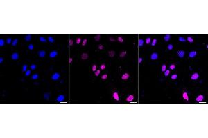 Immunocytochemical staining of H9c2 cells with MEF2A+MEF2C antibody (ABIN7799353), 1:1,000). (Recombinant MEF2A+MEF2C 抗体)