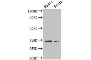 Western Blot Positive WB detected in: Mouse heart tissue, Mouse brain tissue All lanes: CDK5 antibody at 4 μg/mL Secondary Goat polyclonal to rabbit IgG at 1/50000 dilution Predicted band size: 34, 30 kDa Observed band size: 34 kDa (CDK5 抗体  (AA 1-292))