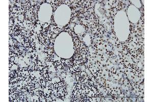 Immunostaining (ISt) image for anti-Stromal Antigen 2 (STAG2) (AA 1130-1231) antibody (ABIN564681)