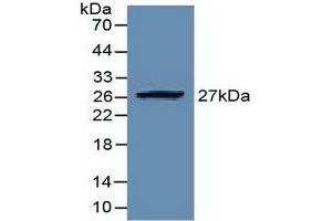 Detection of Recombinant EZH2, Human using Polyclonal Antibody to Enhancer Of Zeste Homolog 2 (EZH2) (EZH2 抗体  (AA 51-285))