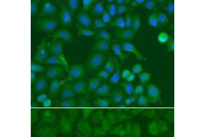 Immunofluorescence analysis of A549 cells using SSX5 Polyclonal Antibody (SSX5 抗体)