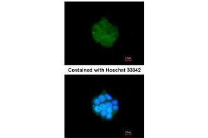 ICC/IF Image Immunofluorescence analysis of methanol-fixed HepG2, using PDK3, antibody at 1:200 dilution. (PDK3 抗体  (Center))