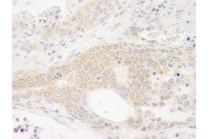 Immunohistochemistry (IHC) image for anti-DEAD (Asp-Glu-Ala-As) Box Polypeptide 19B (DDX19B) (C-Term) antibody (ABIN7448514) (DDX19B 抗体  (C-Term))