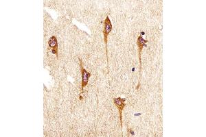 Immunohistochemistry (Paraffin-embedded Sections) (IHC (p)) image for anti-Neurotrophic Tyrosine Kinase, Receptor, Type 2 (NTRK2) antibody (ABIN6242493)