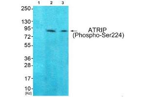 Western blot analysis of extracts from 293 cells (Lane 2) and Hela cells (Lane 3), using ATRIP (Phospho-Ser224) Antibody. (ATRIP 抗体  (pSer224))