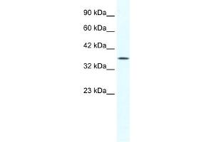WB Suggested Anti-YBX2 Antibody Titration:  1. (YBX2 抗体  (Middle Region))