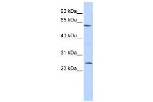 Western Blotting (WB) image for anti-Solute Carrier Family 18 (Vesicular Monoamine Transporter), Member 1 (SLC18A1) antibody (ABIN2458160) (SLC18A1 抗体)