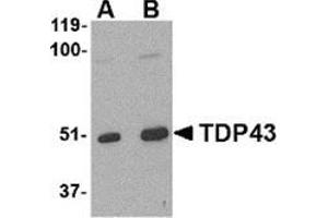 Western blot analysis of TDP43 in L1210 cell lysate with this product at (A) 0. (TARDBP 抗体  (Center))