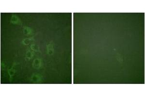 Immunofluorescence analysis of HuvEc cells, using Histamine H1 Receptor (Phospho-Ser398) Antibody.