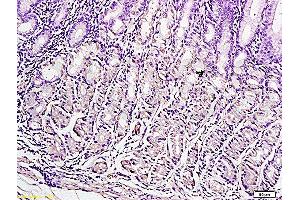 Formalin-fixed and paraffin embedded human gastric tissue labeled with Anti-Leptin Polyclonal Antibody , Unconjugated at 1:300, followed by conjugation to the secondary antibody and DAB staining (Leptin 抗体  (AA 17-100))