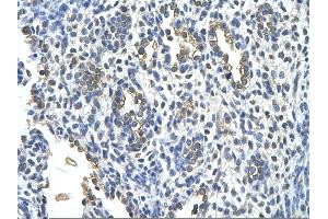 Rabbit Anti-KRT2 Antibody       Paraffin Embedded Tissue:  Human alveolar cell   Cellular Data:  Epithelial cells of renal tubule  Antibody Concentration:   4. (Keratin 2 抗体  (Middle Region))