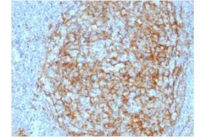 ABIN6383875 to CD14 was successfully used to stain membranes of macrophages in human lymph node and tonsil sections. (CD14 抗体  (Extracellular Domain))