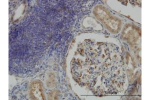 Immunoperoxidase of monoclonal antibody to CRTAP on formalin-fixed paraffin-embedded human kidney.