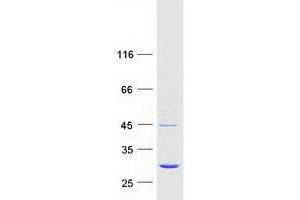Validation with Western Blot