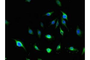 Immunofluorescent analysis of U251 cells using ABIN7143570 at dilution of 1:100 and Alexa Fluor 488-congugated AffiniPure Goat Anti-Rabbit IgG(H+L) (Afadin 抗体  (AA 1663-1809))