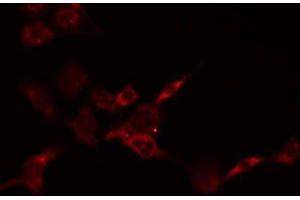 ABIN6278623 staining HepG2 by IF/ICC. (PSCA 抗体)