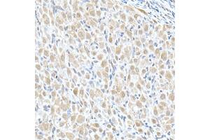 Immunohistochemistry of paraffin-embedded rat ovary using MTAP Rabbit pAb (ABIN6132365, ABIN6144119, ABIN6144120 and ABIN6214763) at dilution of 1:50 (40x lens). (MTAP 抗体  (AA 1-283))