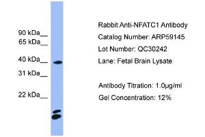 WB Suggested Anti-NFATC1  Antibody Titration: 0. (NFATC1 抗体  (N-Term))