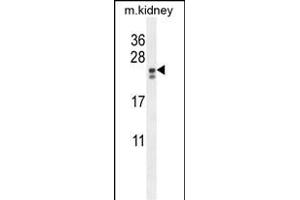 Western Blotting (WB) image for anti-Phosphatidylinositol Glycan Anchor Biosynthesis, Class X (PIGX) (AA 67-95), (N-Term) antibody (ABIN654478)
