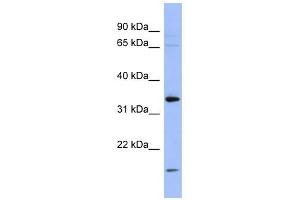 PYCR1 antibody used at 1 ug/ml to detect target protein. (PYCR1 抗体  (Middle Region))
