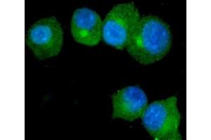 IF analysis of S100A9 using anti-S100A9 antibody (ABIN3042482). (S100A9 抗体  (AA 2-113))