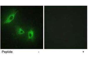 Immunofluorescence analysis of HeLa cells, using ACVR1B polyclonal antibody . (Activin A Receptor Type IB/ALK-4 抗体  (AA 73-122))