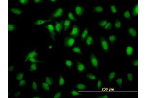 Image no. 2 for anti-SH2 Domain Containing 4A (SH2D4A) (AA 239-338) antibody (ABIN599292) (SH2D4A 抗体  (AA 239-338))