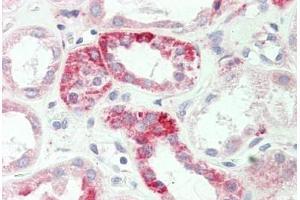 Human Kidney: Formalin-Fixed, Paraffin-Embedded (FFPE) (ADORA1 抗体  (Asp326))