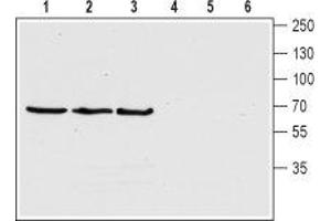 Western blot analysis of human SH-5YSY neuroblastoma cell lysate (lanes 1 and 4), rat (lanes 2 and 5) and mouse (lanes 3 and 6) brain lysates: - 1-3. (ChT 抗体  (4th Extracellular Loop))
