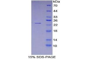 SDS-PAGE analysis of Mouse LEDGF Protein. (PSIP1 蛋白)