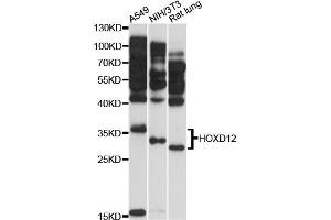 Western blot analysis of extracts of various cell lines, using HOXD12 antibody (ABIN6290492) at 1:3000 dilution. (HOXD12 抗体)