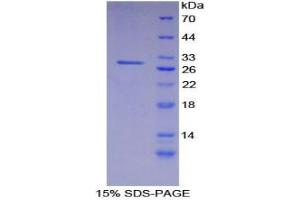 SDS-PAGE analysis of Human Integrin alpha D Protein. (ITGAD 蛋白)