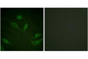 Immunofluorescence analysis of HeLa cells, using Keratin 18 (Phospho-Ser33) Antibody. (Cytokeratin 18 抗体  (pSer34))