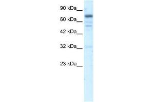 WB Suggested Anti-RIN3 Antibody Titration:  5. (RIN3 抗体  (N-Term))