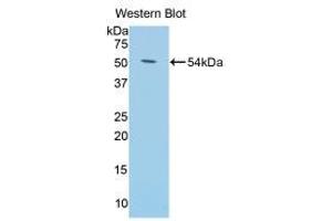 Western blot analysis of the recombinant protein. (Klotho 抗体  (AA 59-508))