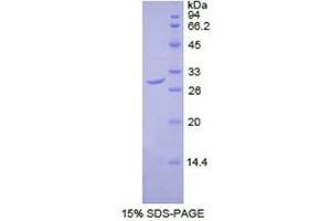 SDS-PAGE (SDS) image for Dihydrolipoyl Transacetylase (DLAT) (AA 374-631) protein (His tag) (ABIN1877619)