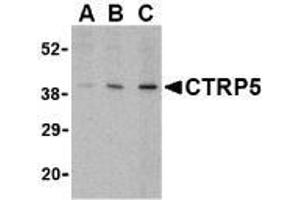 Western blot analysis of CTRP5 in caco-2 cell lysate with AP30255PU-N CTRP5 antibody at (A) 1, (B) 2, and (C) 4 μg/ml. (CTRP5 抗体  (Intermediate Domain))