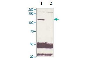 5 mg of the whole cell lysate derived from conditioned LNCaP were immunoprecipitated by 4 ug of AR (phospho S210) polyclonal antibody (Cat # PAB12654, lane 1) or pre adsorbed by immunization peptide (lane 2) followed by AR polyclonal antibody  at 1 : 500. (Androgen Receptor 抗体  (pSer210))