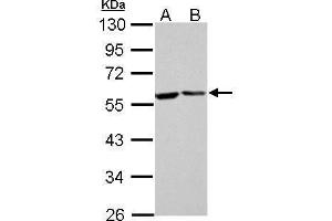 WB Image FKBP4 antibody detects FKBP4 protein by Western blot analysis. (FKBP4 抗体  (Center))