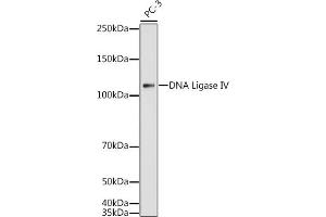 Western blot analysis of extracts of PC-3 cells, using DNA Ligase IV antibody (ABIN3022474, ABIN3022475, ABIN3022476 and ABIN6218843) at 1:1000 dilution. (LIG4 抗体  (AA 612-911))