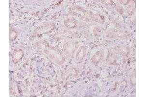 Immunohistochemistry of paraffin-embedded human kidney tissue using ABIN7159497 at dilution of 1:100 (TIMP4 抗体  (AA 31-224))