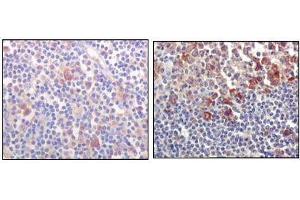 Immunohistochemical analysis of paraffin-embedded human lymph-node tissues (left) and human lymph follicle tissues (right), showing cytoplasmic and membrane localization using BTK mouse mAb with DAB staining. (BTK 抗体)