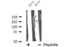 Western blot analysis of ZFYVE9 using HeLa whole cell lysates (ZFYVE9 抗体  (C-Term))