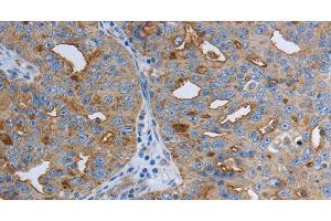 Immunohistochemistry (Paraffin-embedded Sections) (IHC (p)) image for anti-Solute Carrier Family 34 (Sodium Phosphate), Member 2 (SLC34A2) antibody (ABIN7242428)