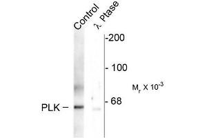 Image no. 1 for anti-Polo-Like Kinase 1 (PLK1) (pThr210) antibody (ABIN372703) (PLK1 抗体  (pThr210))
