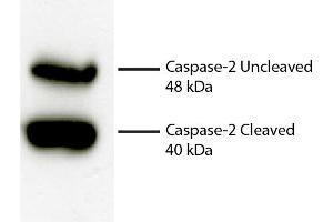 Total cell lysates from Jurkat cells were incubated with Rabbit Anti-Human DR5-UNLB secondary antibody and chemiluminescent detection. (Caspase 2 抗体)