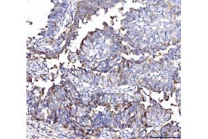 IHC analysis of CD55 using anti-CD55 antibody (ABIN7601422).