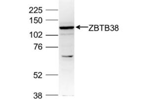 Western Blot of anti-ZBTB38 antibody Western Blot results of Rabbit anti-ZBTB38 antibody. (ZBTB38 抗体  (C-Term, Internal Region))