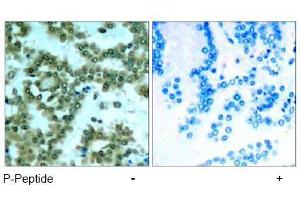 Image no. 1 for anti-Protein Kinase C, theta (PRKCQ) (pSer676) antibody (ABIN197070) (PKC theta 抗体  (pSer676))